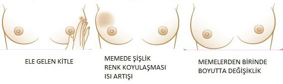 kendi-kendine-meme-muayenesi-4