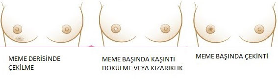 kendi-kendine-meme-muayenesi-5