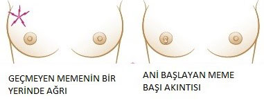 kendi-kendine-meme-muayenesi-6